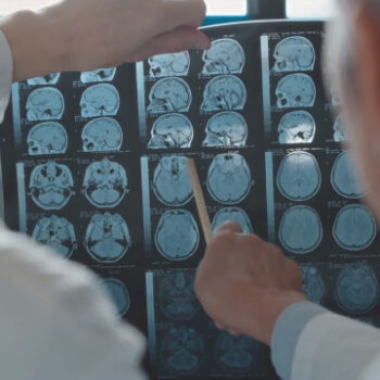 alzheimer,-terapie-allo-studio-per-rallentare-il-decorso