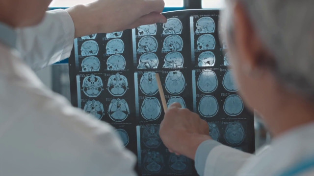 alzheimer,-terapie-allo-studio-per-rallentare-il-decorso