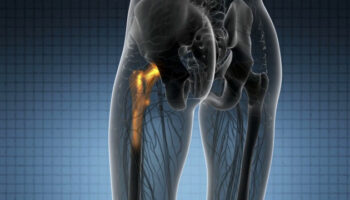 bioaction,-progetto-ue-contro-infezioni-associate-alle-protesi