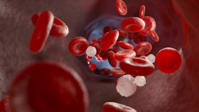 trombosi,-ecco-quali-sono-i-sintomi-da-non-trascurare