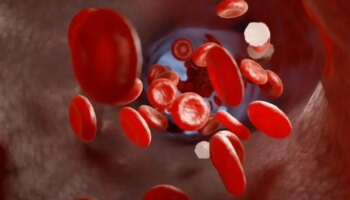 trombosi-alla-base-di-gravi-malattie,-in-italia-600.000-ogni-anno