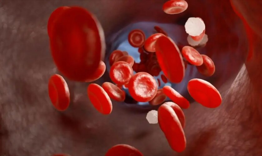 trombosi-alla-base-di-gravi-malattie,-in-italia-600.000-ogni-anno