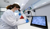 il-monitoraggio-stretto-facilita-la-diagnosi-precoce-del-tumore-al-pancreas