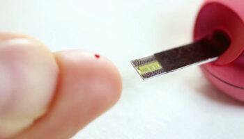 diabete-di-tipo-1-autoimmune,-nuovi-studi-su-un-farmaco