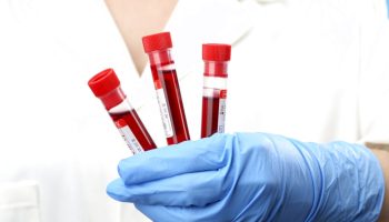 test-del-sangue-low-cost-che-rileva-tumori-e-malattie-dal-dna-circolante