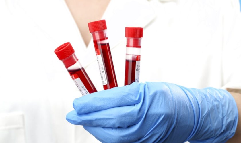 test-del-sangue-low-cost-che-rileva-tumori-e-malattie-dal-dna-circolante